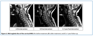 usf cervical study figure mri