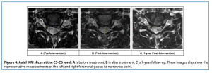 usf cervical study figure mri