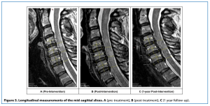 usf cervical study figure mri